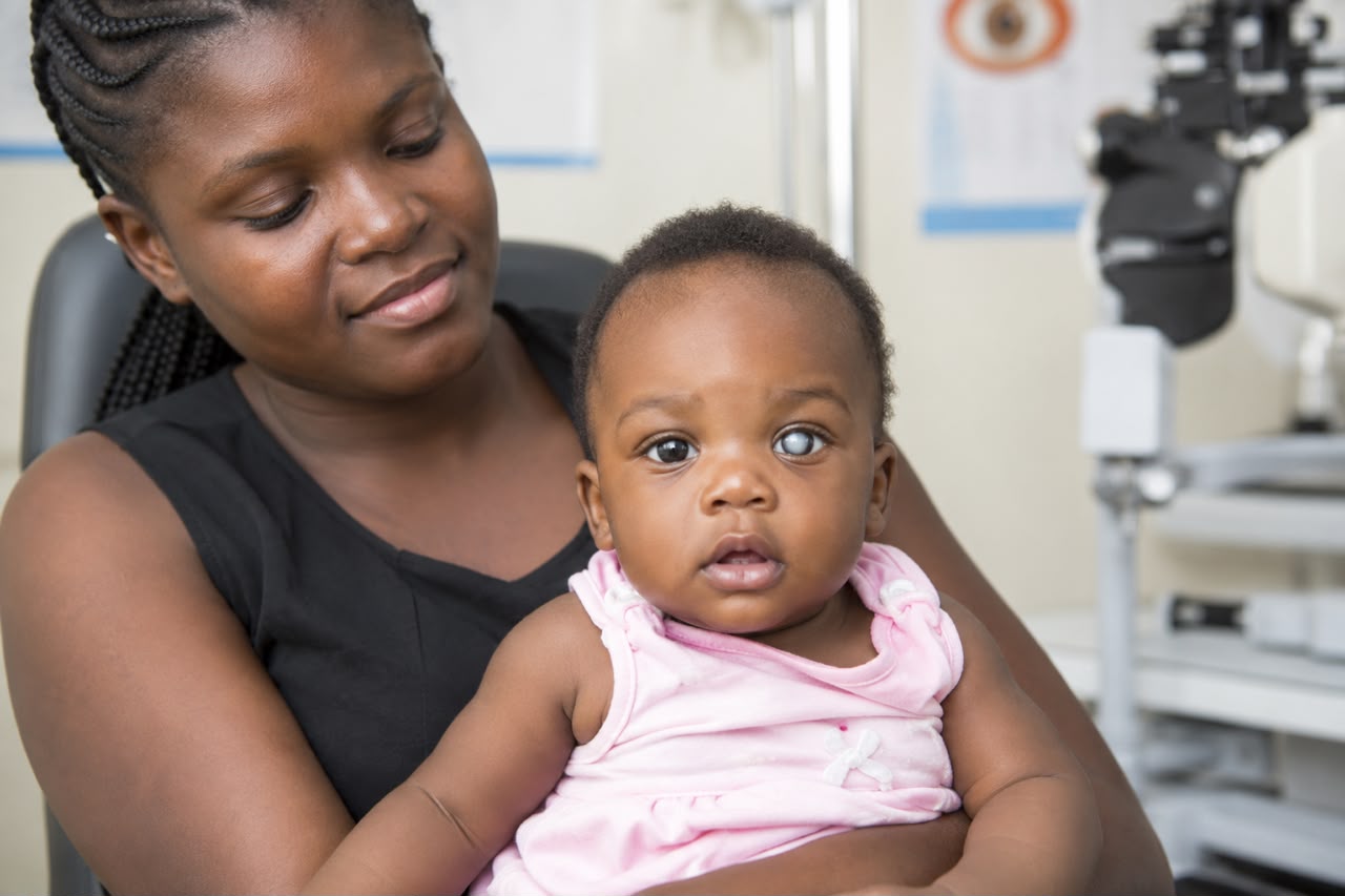 mother-holding-baby-with-congenital-cataract Mother holding a baby with congenital cataract, highlighting the importance of early diagnosis and treatment of childhood eye conditions.