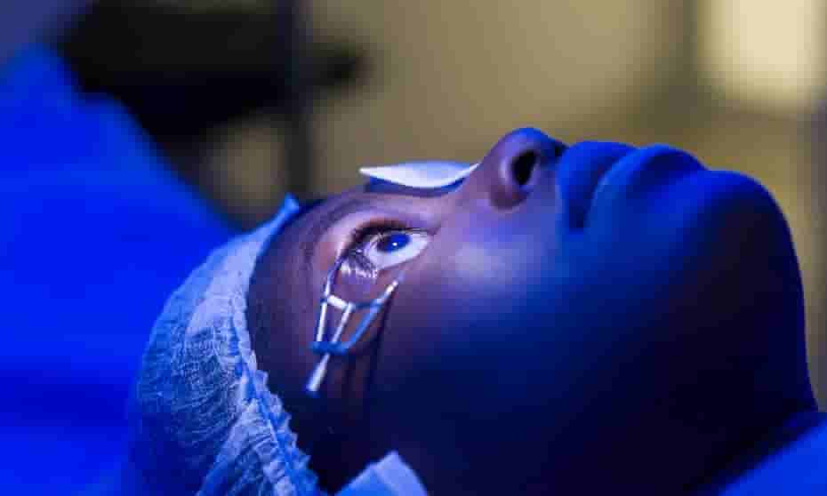 Patient undergoing laser treatment for glaucoma to help lower eye pressure and preserve vision.